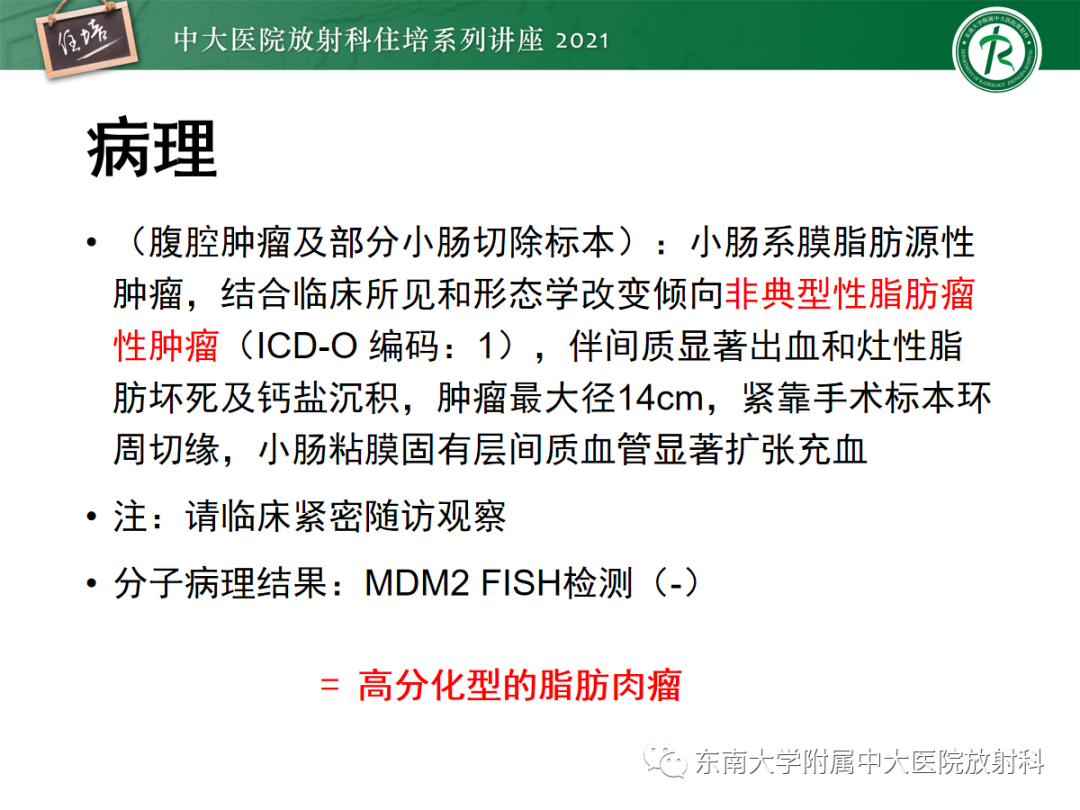影像PPT - 【PPT】腹膜病变的影像分析思路-56