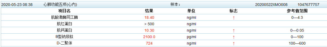 影像PPT - 胸部 CT 弥漫或多发磨玻璃影的影像鉴别诊断-2 影像PPT - 胸部 CT 弥漫或多发磨玻璃影的影像鉴别诊断-2