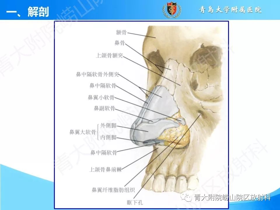 影像PPT - 【PPT】鼻和鼻窦解剖及常见病影像诊断-3