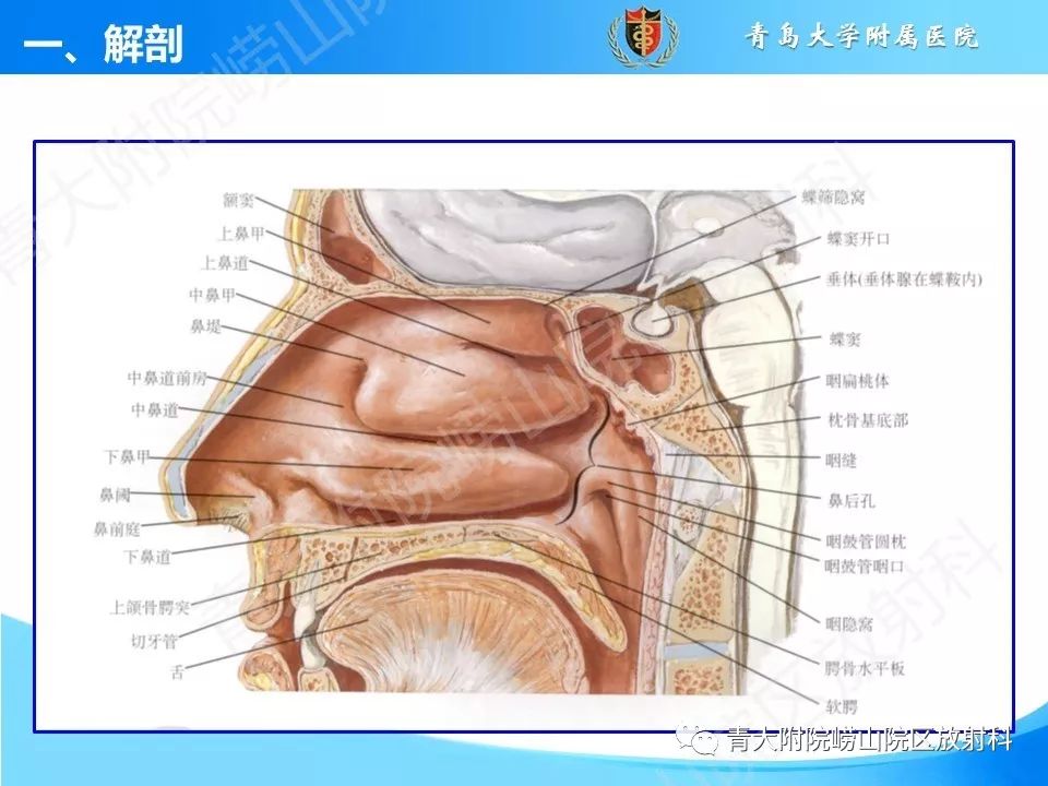 影像PPT - 【PPT】鼻和鼻窦解剖及常见病影像诊断-4
