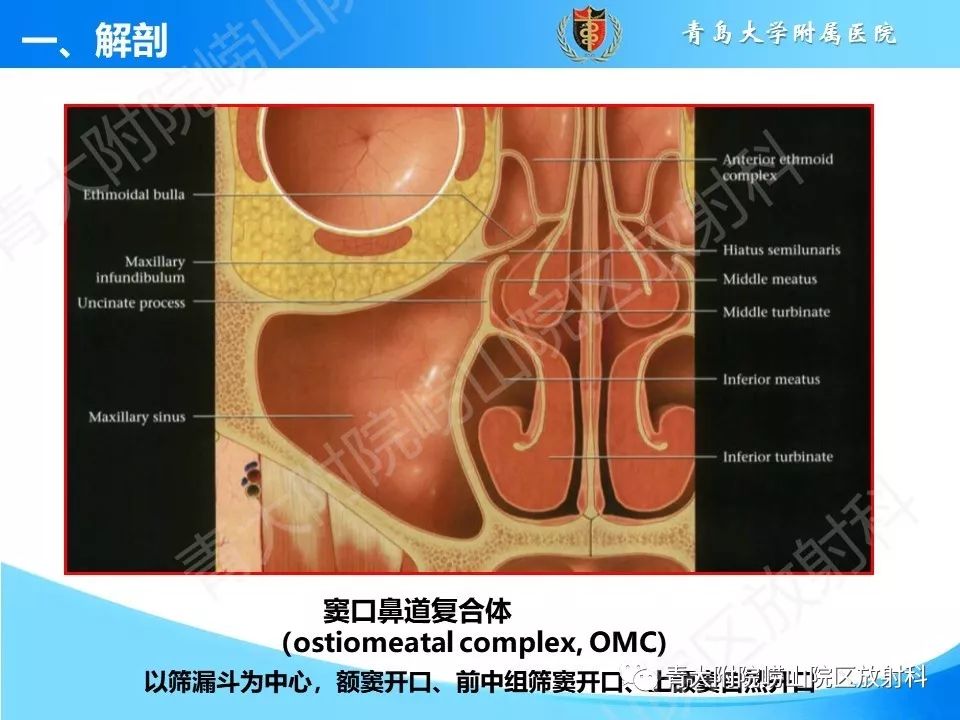 影像PPT - 【PPT】鼻和鼻窦解剖及常见病影像诊断-8