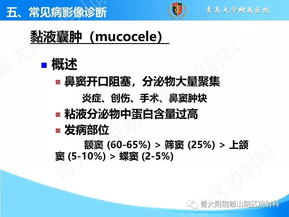 影像PPT - 【PPT】鼻和鼻窦解剖及常见病影像诊断-30