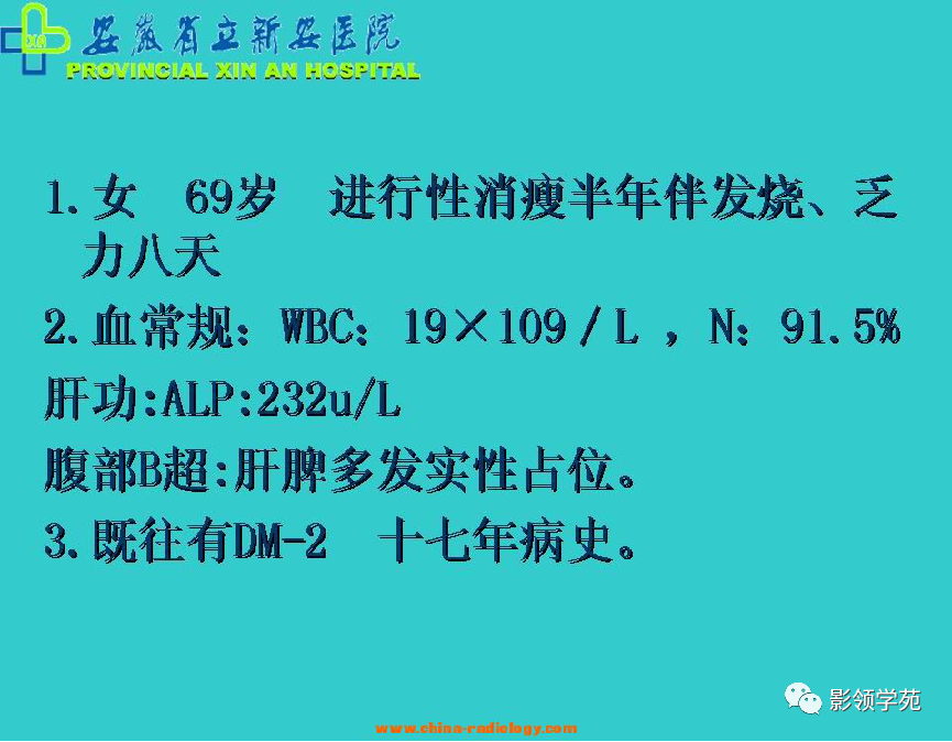影像PPT - 脾脏肿瘤CT诊断-13 影像PPT - 脾脏肿瘤CT诊断-13