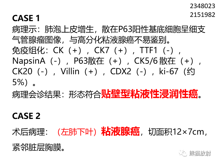 影像PPT - 【病例】肺黏液腺癌2例CT影像-21