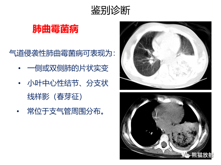 影像PPT - 【病例】肺黏液腺癌2例CT影像-32