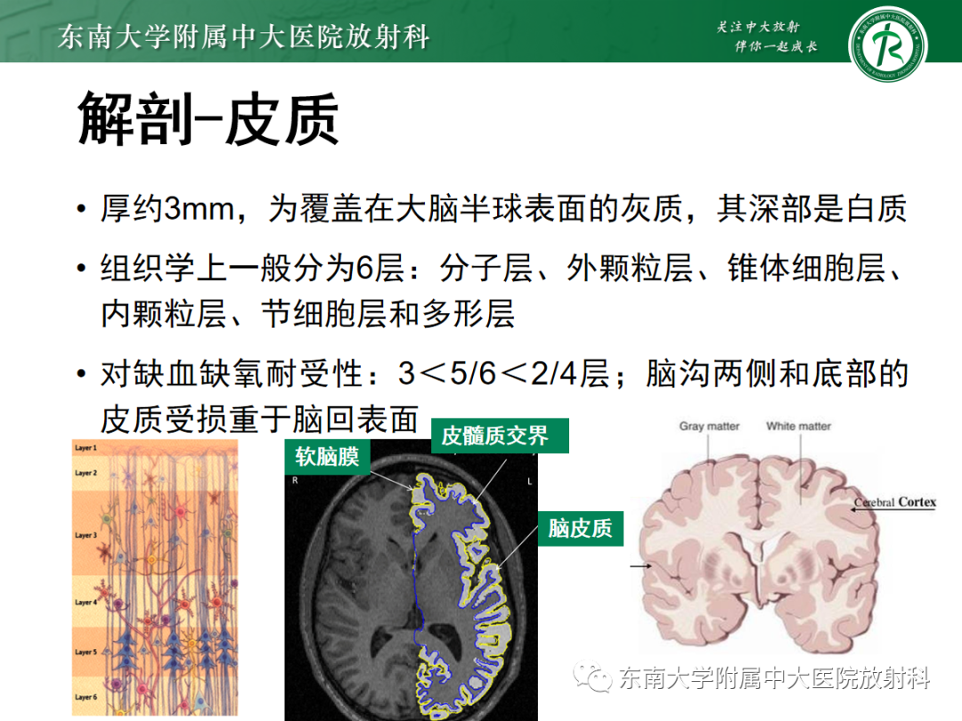 影像PPT - 【PPT】脑皮质层状坏死的影像-8