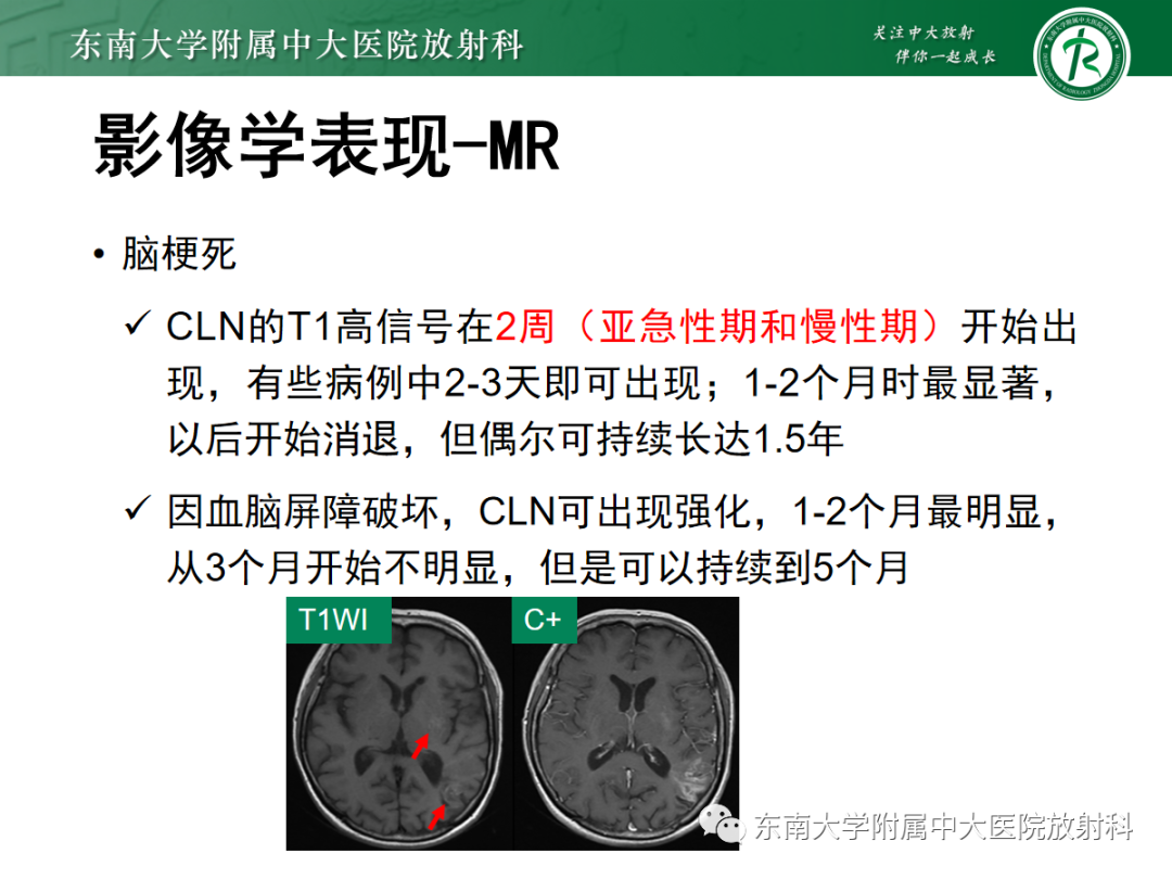 影像PPT - 【PPT】脑皮质层状坏死的影像-14