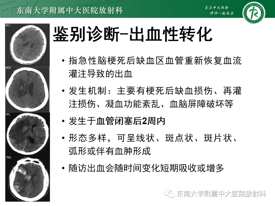 影像PPT - 【PPT】脑皮质层状坏死的影像-17