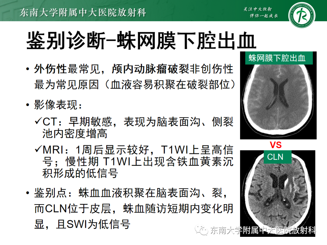 影像PPT - 【PPT】脑皮质层状坏死的影像-21