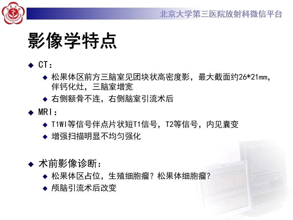 影像PPT - 【PPT】松果体区生殖细胞瘤-7