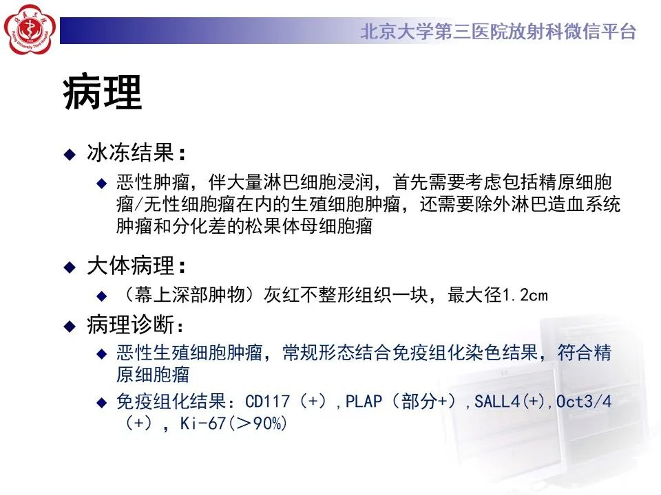影像PPT - 【PPT】松果体区生殖细胞瘤-9