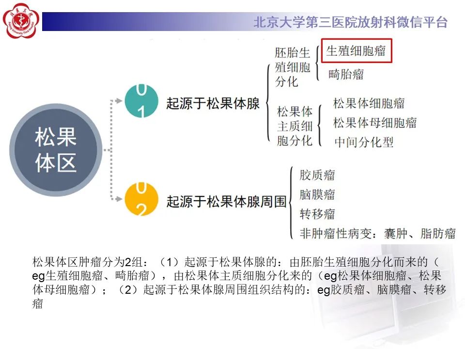 影像PPT - 【PPT】松果体区生殖细胞瘤-11