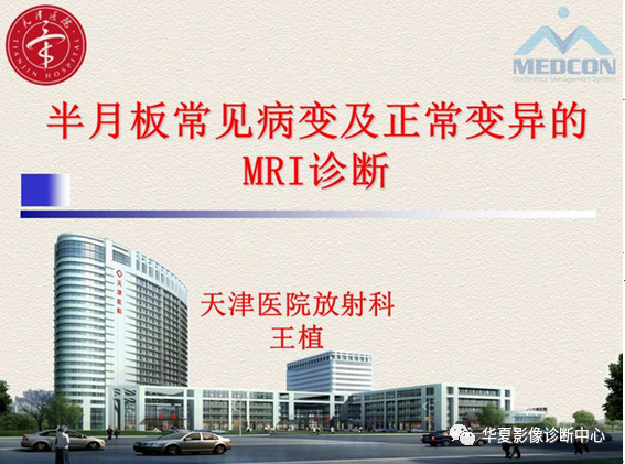 影像PPT - 【PPT】半月板常见病变及正常变异的MRI诊断-1