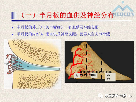影像PPT - 【PPT】半月板常见病变及正常变异的MRI诊断-4