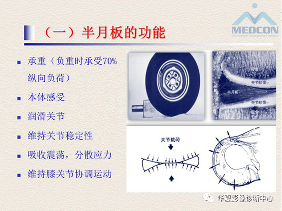 影像PPT - 【PPT】半月板常见病变及正常变异的MRI诊断-6