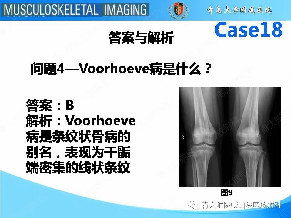 影像PPT - 【PPT】蜡泪样骨病-14