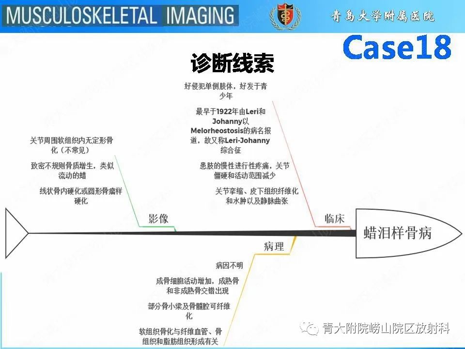 影像PPT - 【PPT】蜡泪样骨病-19