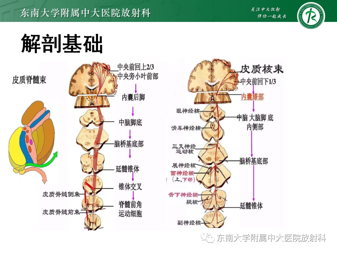 影像PPT - 【PPT】华勒变性-7