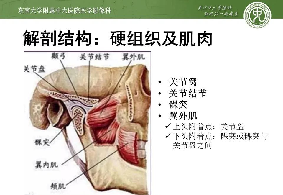 影像PPT - 【PPT】颞下颌关节紊乱病影像诊断-6