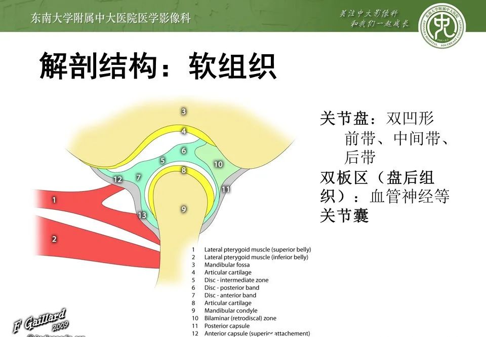 影像PPT - 【PPT】颞下颌关节紊乱病影像诊断-7