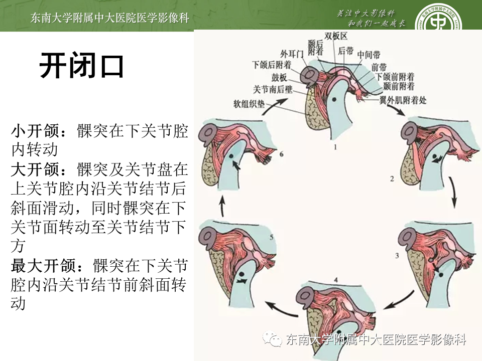 影像PPT - 【PPT】颞下颌关节紊乱病影像诊断-10