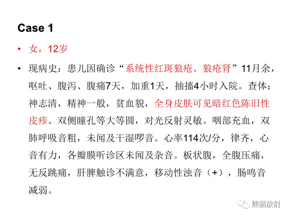 影像PPT - 【病例】可逆性后部脑病综合征2例MR影像-2