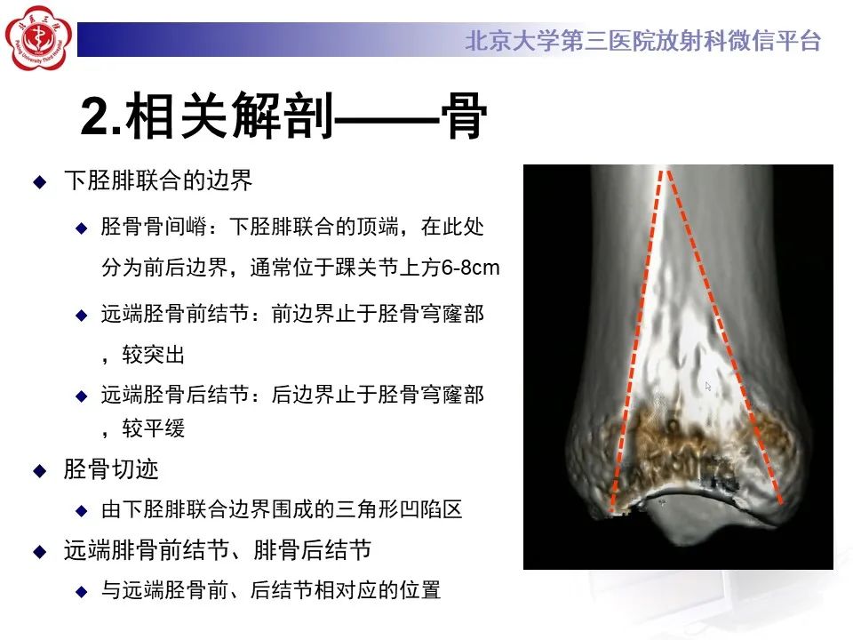 影像PPT - 【PPT】下胫腓联合损伤的影像-8