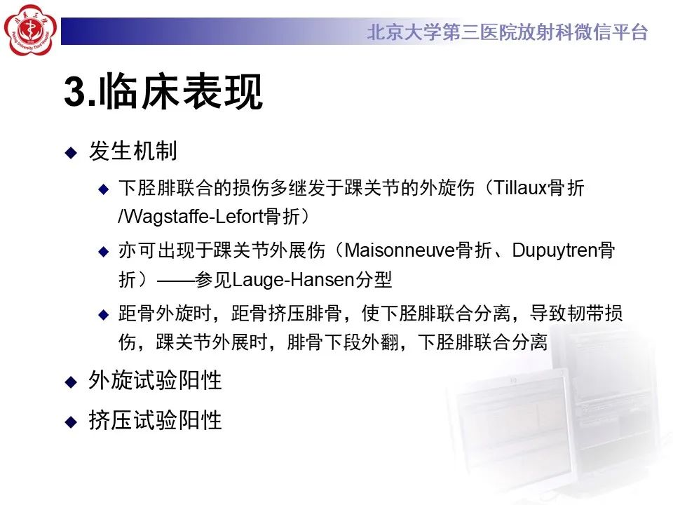 影像PPT - 【PPT】下胫腓联合损伤的影像-15