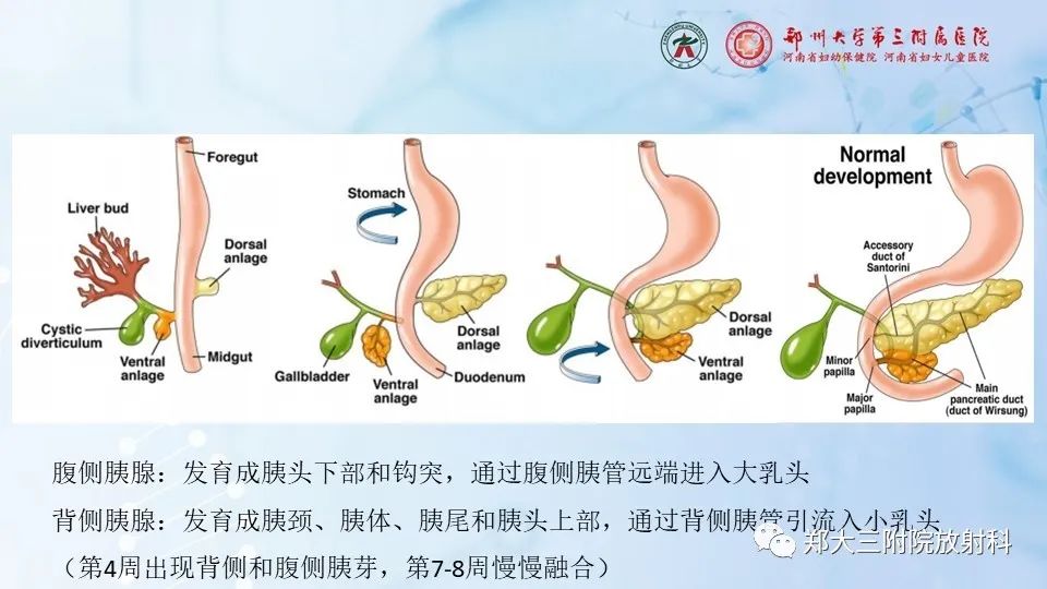 影像PPT - 【PPT】胰腺良性上皮性肿瘤及癌前病变-3