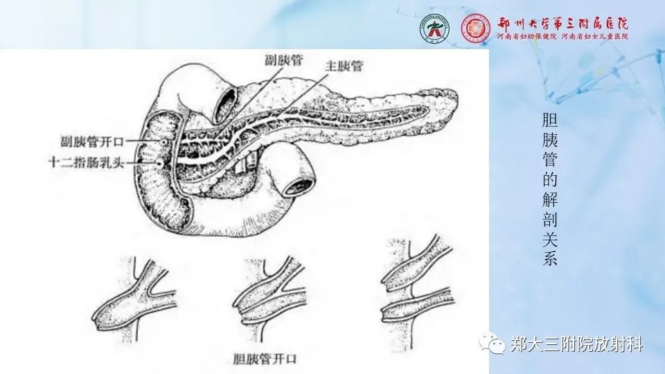 影像PPT - 【PPT】胰腺良性上皮性肿瘤及癌前病变-8