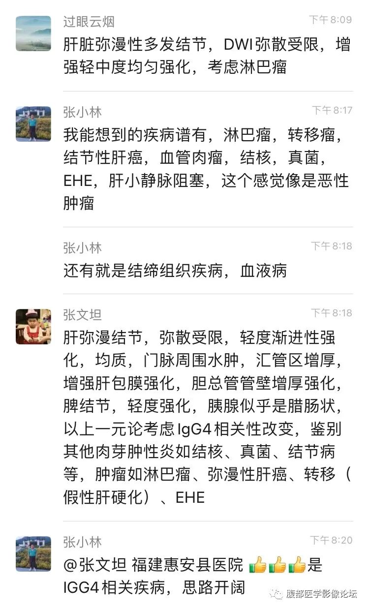 影像PPT - 【病例】肝脏弥漫B细胞淋巴瘤1例CT及MR-26