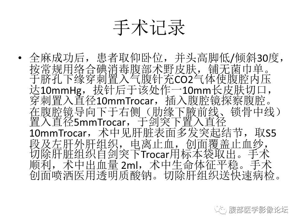 影像PPT - 【病例】肝脏弥漫B细胞淋巴瘤1例CT及MR-30