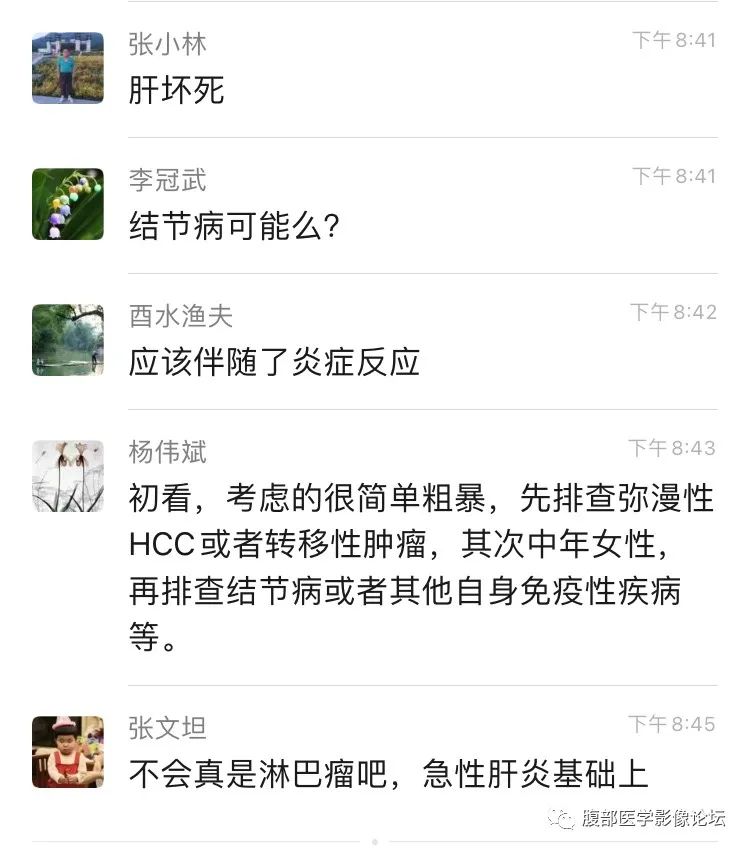 影像PPT - 【病例】肝脏弥漫B细胞淋巴瘤1例CT及MR-29