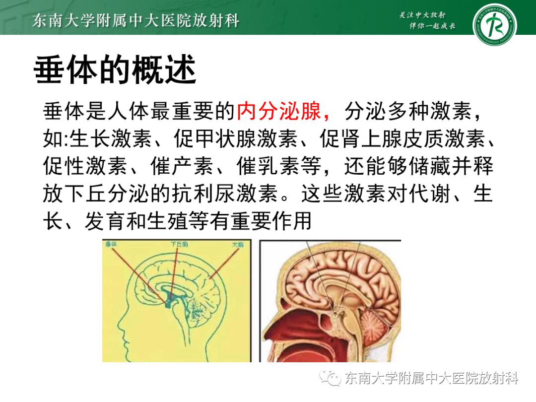 影像PPT - 【PPT】垂体Rathke囊肿的MRI表现-3