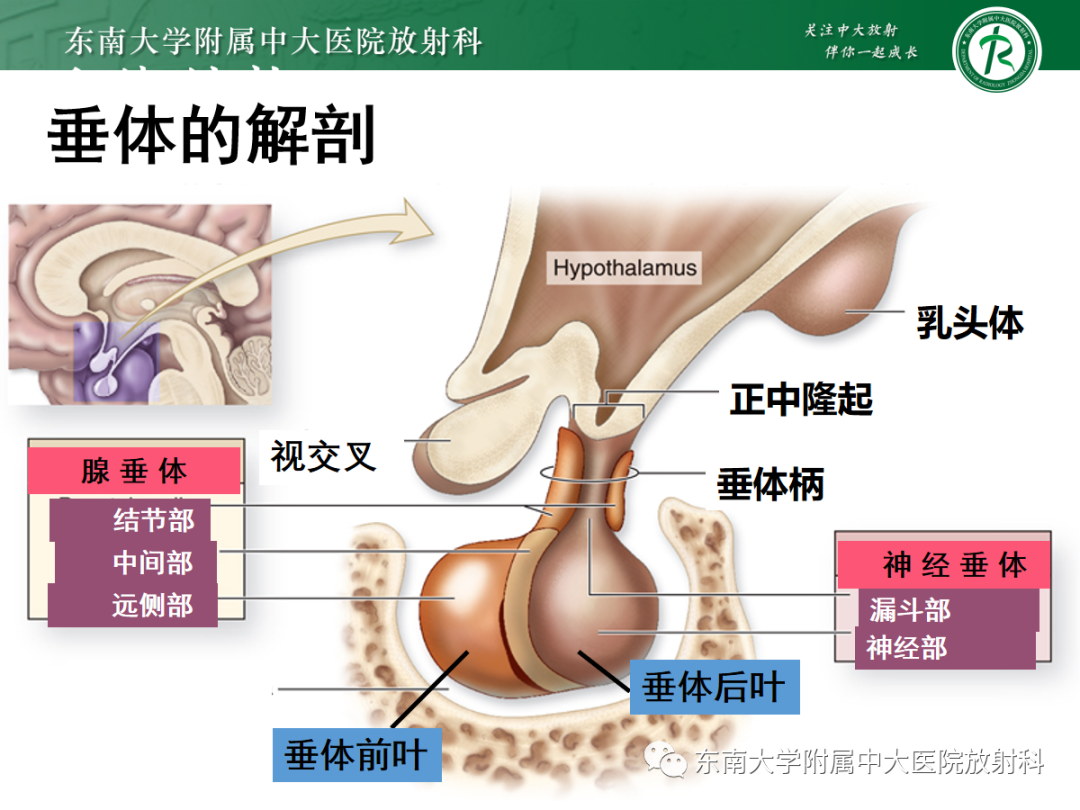 影像PPT - 【PPT】垂体Rathke囊肿的MRI表现-4