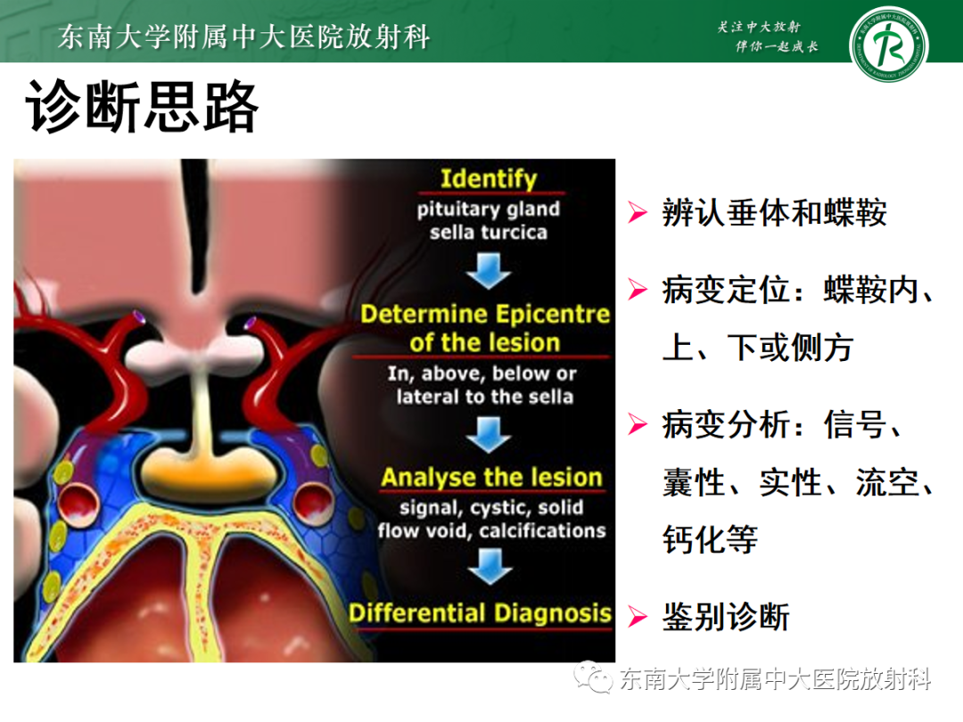 影像PPT - 【PPT】垂体Rathke囊肿的MRI表现-12