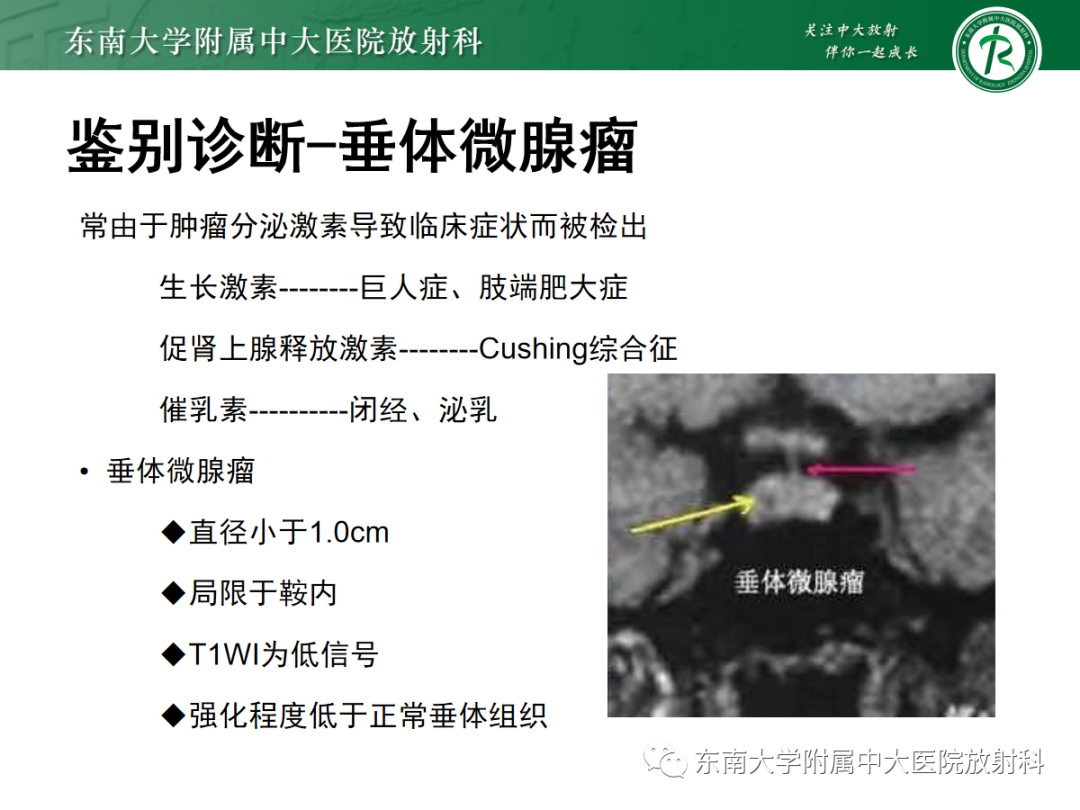 影像PPT - 【PPT】垂体Rathke囊肿的MRI表现-25