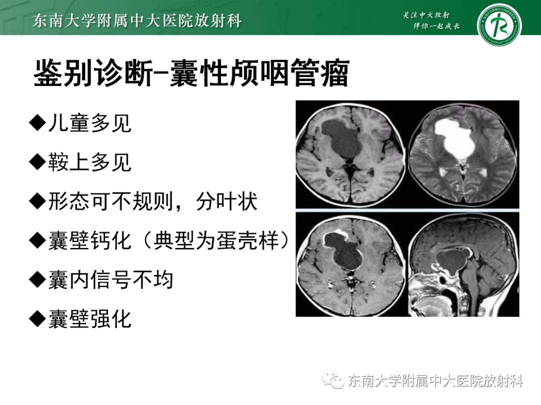 影像PPT - 【PPT】垂体Rathke囊肿的MRI表现-32