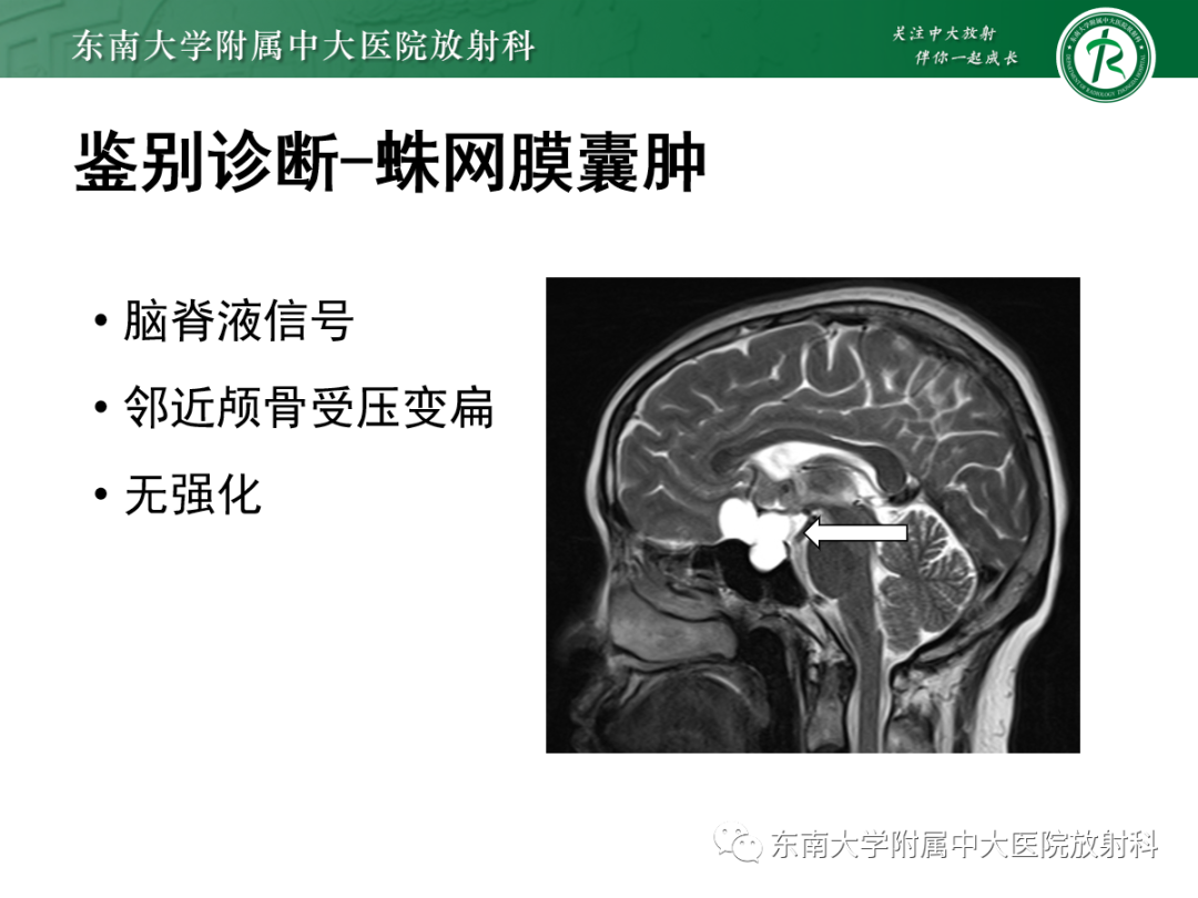 影像PPT - 【PPT】垂体Rathke囊肿的MRI表现-37