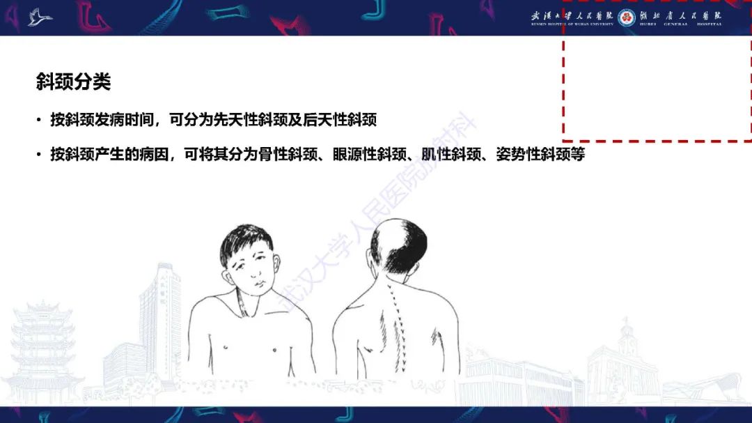 影像PPT - 【PPT】儿童斜颈影像诊断-3
