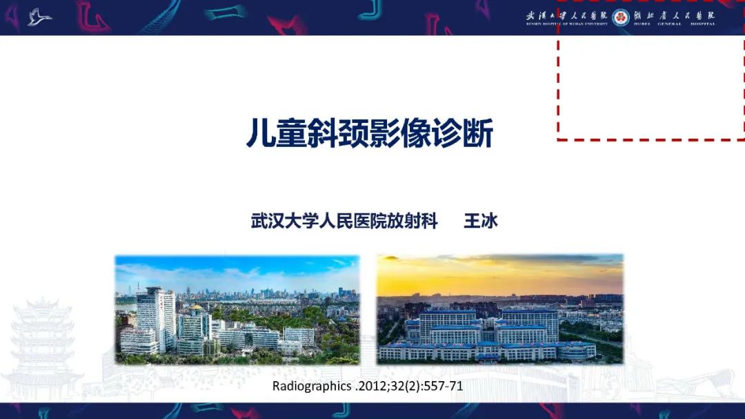 影像PPT - 【PPT】儿童斜颈影像诊断-1