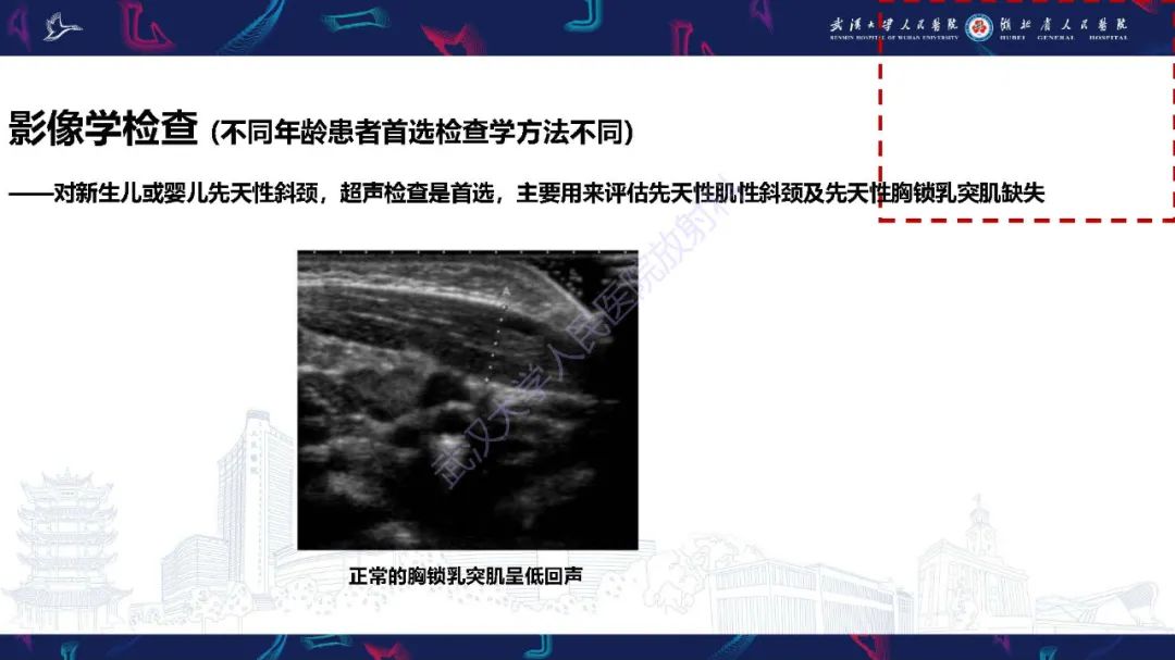 影像PPT - 【PPT】儿童斜颈影像诊断-7