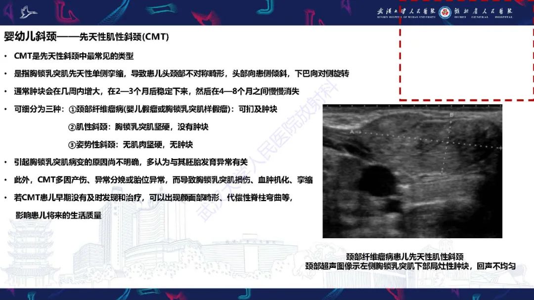 影像PPT - 【PPT】儿童斜颈影像诊断-10