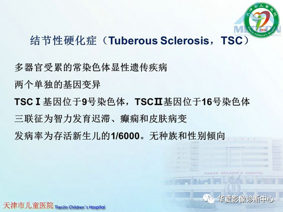 影像PPT - 【PPT】儿童常见神经皮肤综合征影像诊断-4