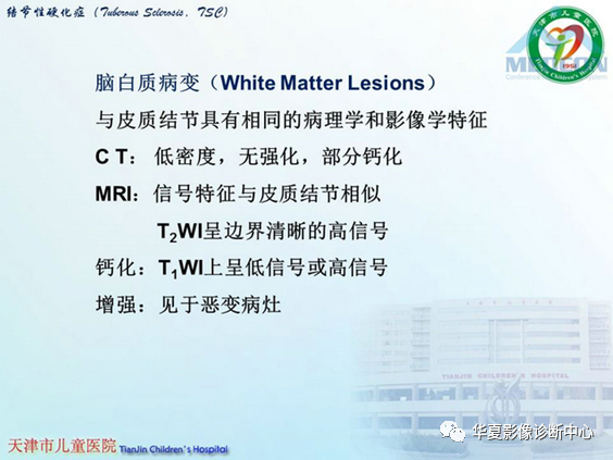 影像PPT - 【PPT】儿童常见神经皮肤综合征影像诊断-20