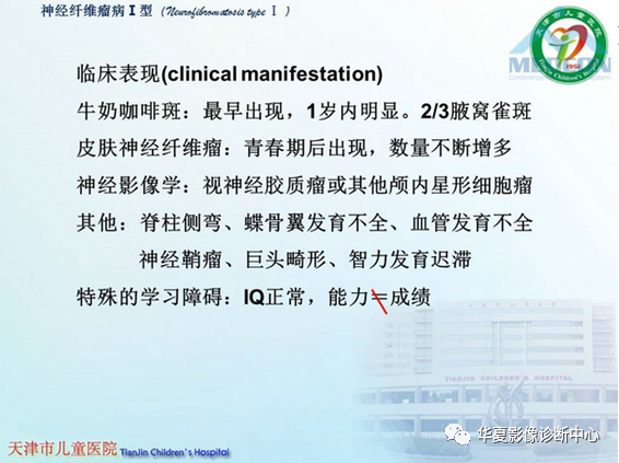 影像PPT - 【PPT】儿童常见神经皮肤综合征影像诊断-42