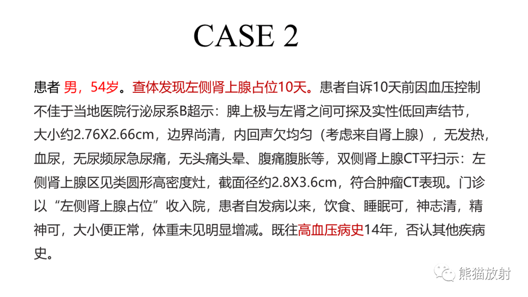 影像PPT - 【病例】异位胰腺2例CT及MR影像-6
