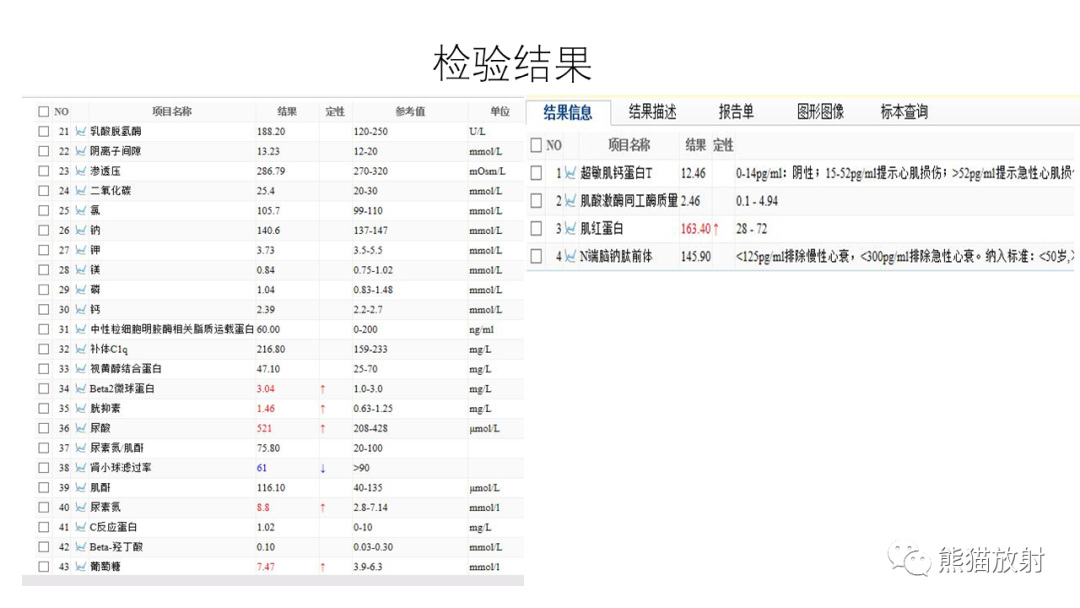 影像PPT - 【病例】异位胰腺2例CT及MR影像-8