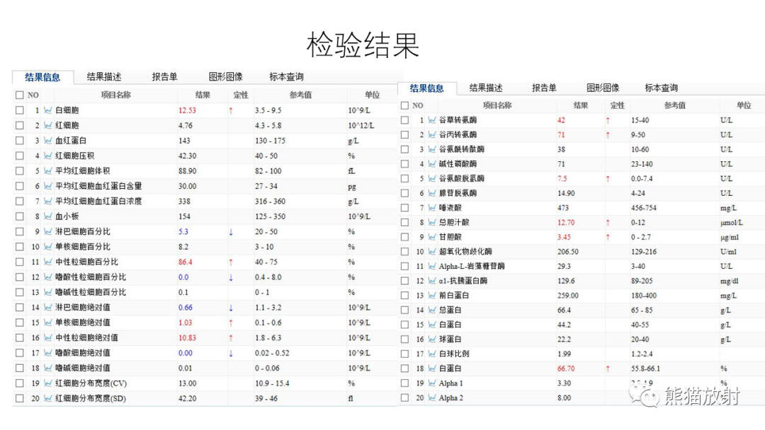 影像PPT - 【病例】异位胰腺2例CT及MR影像-7