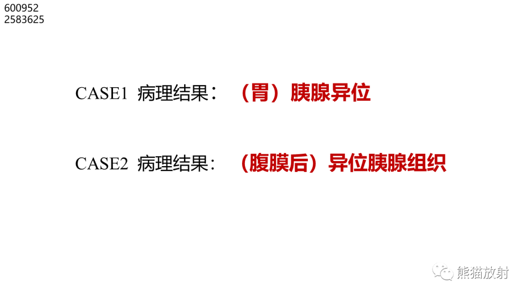 影像PPT - 【病例】异位胰腺2例CT及MR影像-18